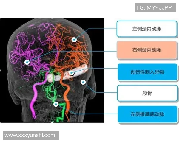 TES战术解析:深入探讨英雄联盟中的防反体系与实战应用 TES战术解析:深入探讨英雄联盟中的防反体系与实战应用
